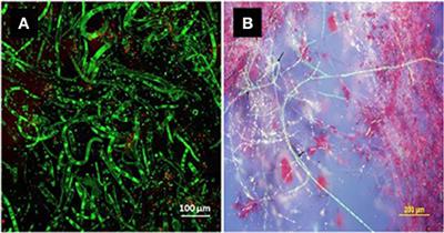 White Leaf Spot Caused by Neopseudocercosporella capsellae: A Re-emerging Disease of Brassicaceae